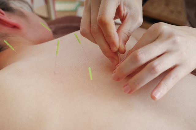 鍼施術